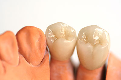 Benson Family Dentistry | Pediatric Dentistry, Dentures and Oral Exams