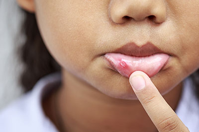 Benson Family Dentistry | Night Guards, Paperless Charting and Oral Cancer Screening